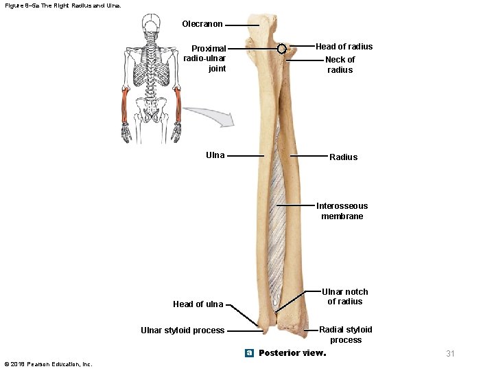 Figure 8– 5 a The Right Radius and Ulna. Olecranon Proximal radio-ulnar joint Head