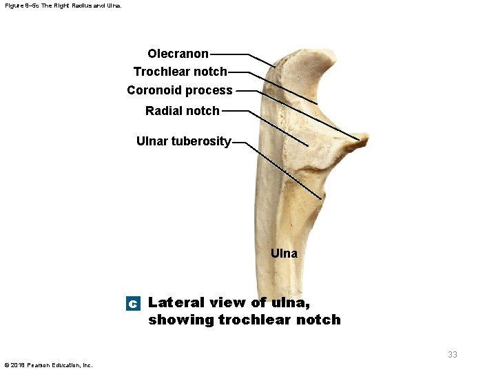 Figure 8– 5 c The Right Radius and Ulna. Olecranon Trochlear notch Coronoid process