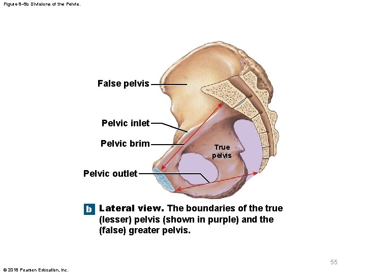 Figure 8– 9 b Divisions of the Pelvis. False pelvis Pelvic inlet Pelvic brim