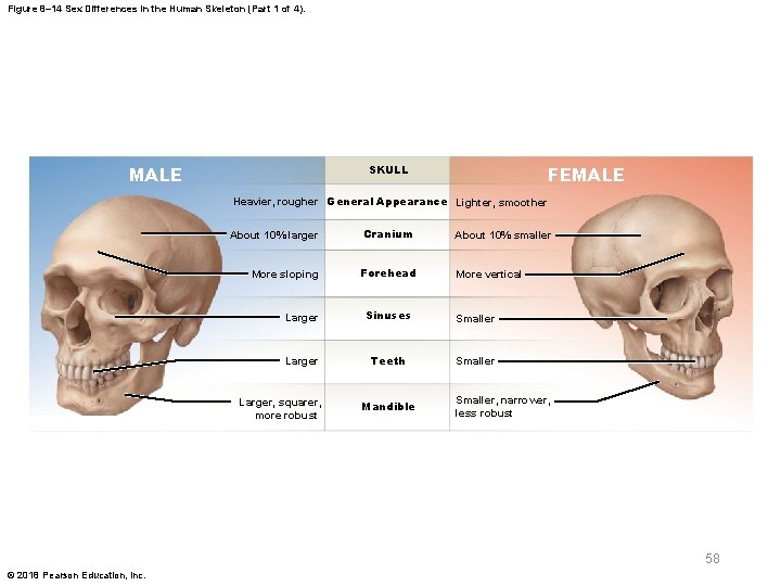 Figure 8– 14 Sex Differences in the Human Skeleton (Part 1 of 4). MALE