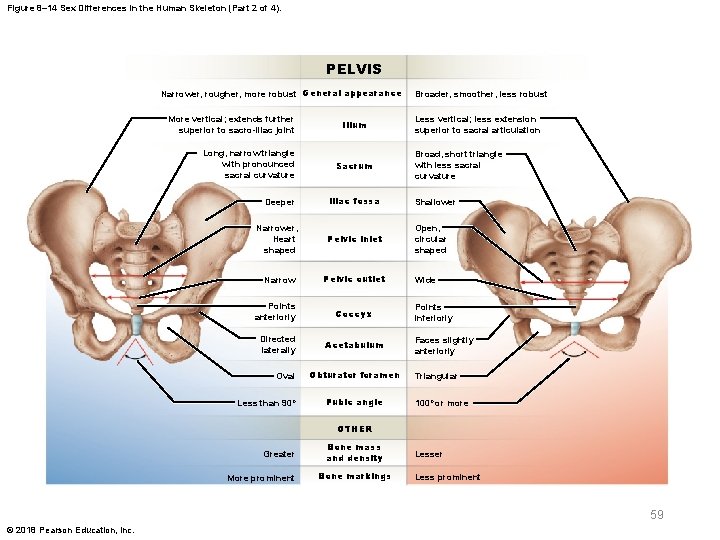 Figure 8– 14 Sex Differences in the Human Skeleton (Part 2 of 4). PELVIS