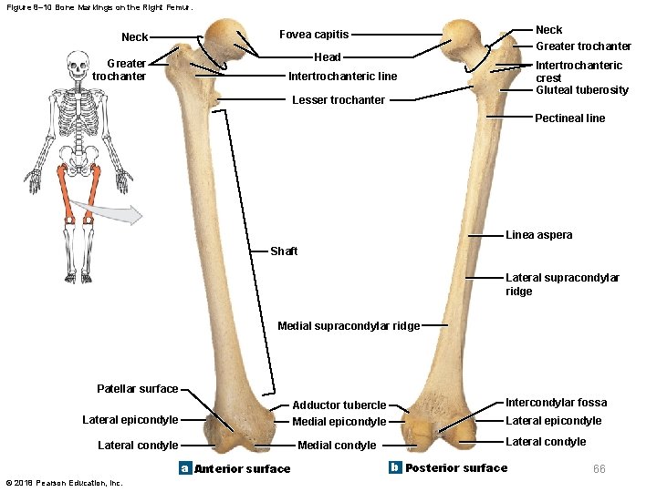 Figure 8– 10 Bone Markings on the Right Femur. Neck Greater trochanter Fovea capitis
