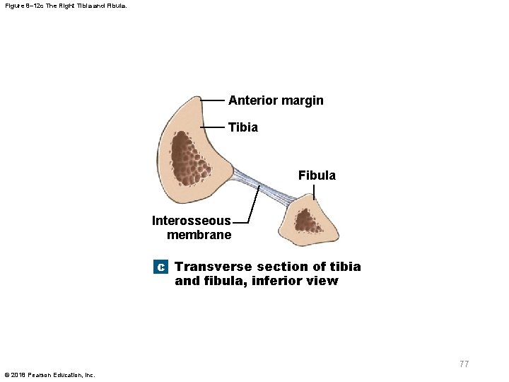Figure 8– 12 c The Right Tibia and Fibula. Anterior margin Tibia Fibula Interosseous
