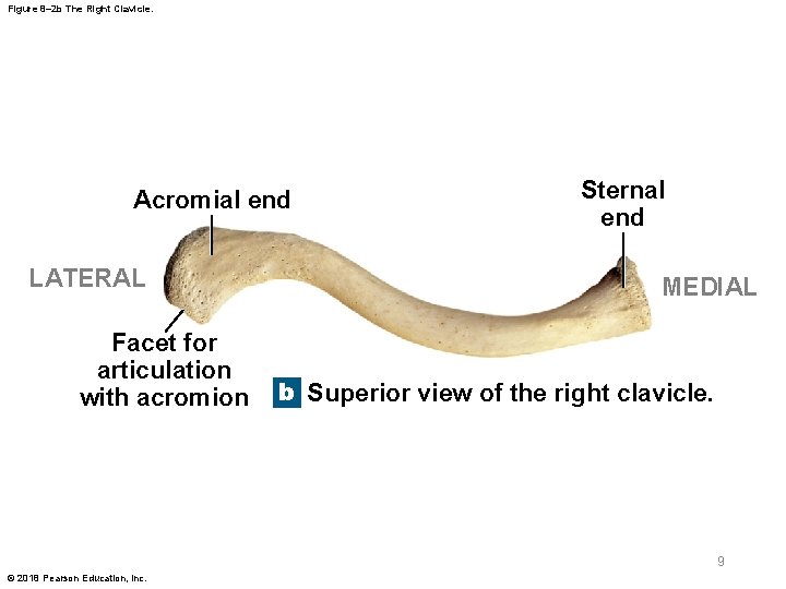 Figure 8– 2 b The Right Clavicle. Acromial end LATERAL Facet for articulation with