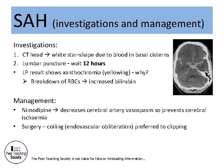 SAH (investigations and management) Investigations: 1. CT head white star-shape due to blood in