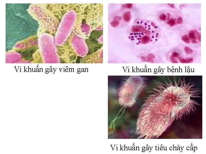 Vi khuẩn gây viêm gan Vi khuẩn gây bệnh lậu Vi khuẩn gây tiêu