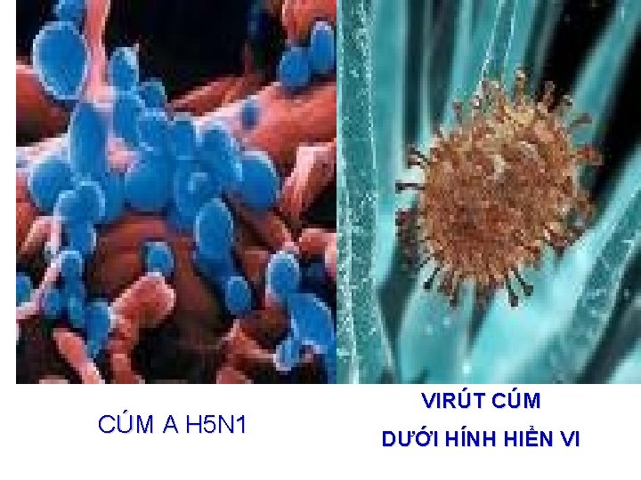 CÚM A H 5 N 1 VIRÚT CÚM DƯỚI HÍNH HIỂN VI 