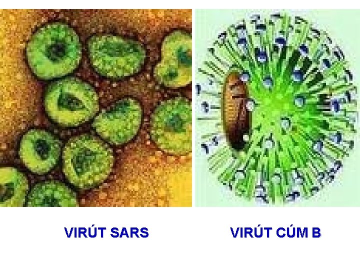 VIRÚT SARS VIRÚT CÚM B 