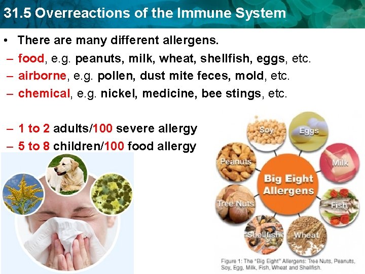 31. 5 Overreactions of the Immune System • – – – There are many