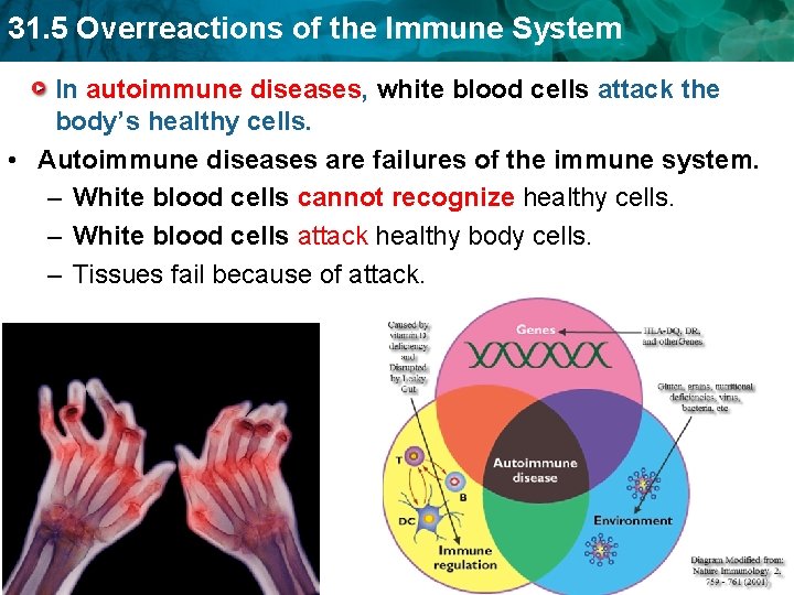 31. 5 Overreactions of the Immune System In autoimmune diseases, white blood cells attack