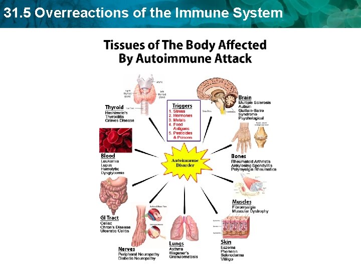 31. 5 Overreactions of the Immune System 