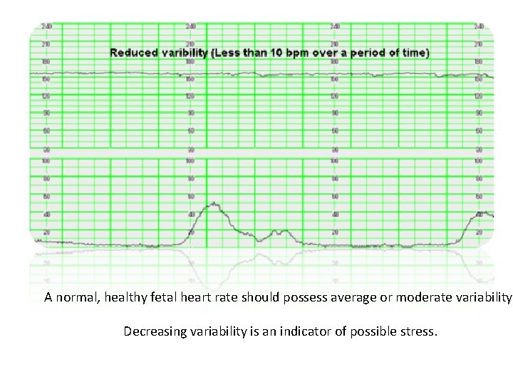 A normal, healthy fetal heart rate should possess average or moderate variability. Decreasing variability