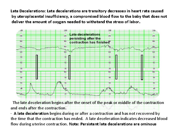 Late Decelerations: Late decelerations are transitory decreases in heart rate caused by uteroplacental insufficiency,