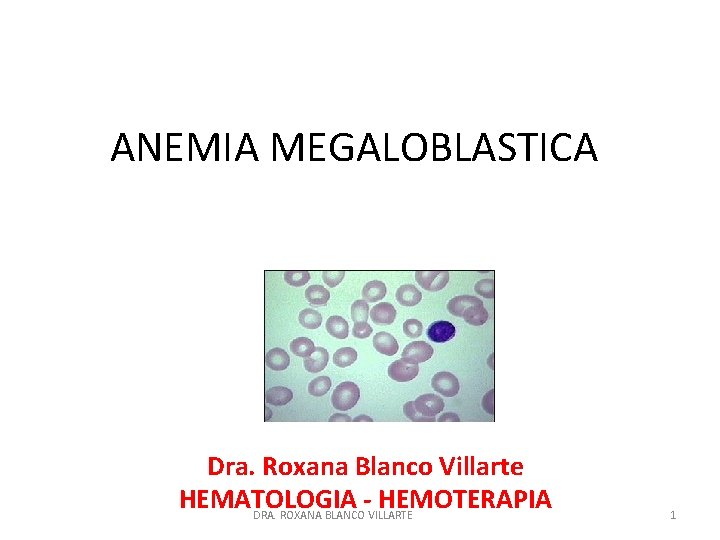 ANEMIA MEGALOBLASTICA Dra. Roxana Blanco Villarte HEMATOLOGIA - HEMOTERAPIA DRA. ROXANA BLANCO VILLARTE 1