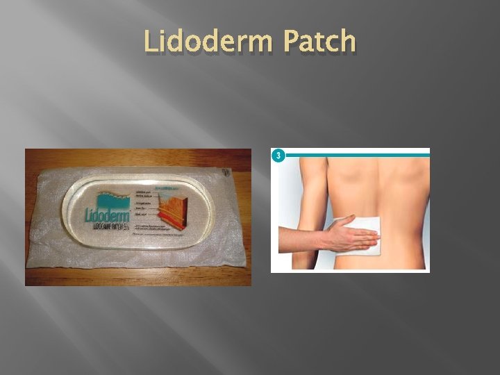 Lidoderm Patch 