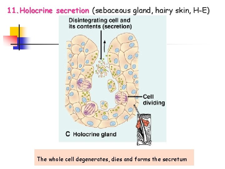 11. Holocrine secretion (sebaceous gland, hairy skin, H-E) The whole cell degenerates, dies and