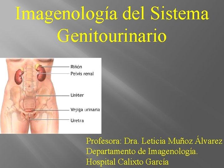 Imagenología del Sistema Genitourinario Profesora: Dra. Leticia Muñoz Álvarez Departamento de Imagenología. Hospital Calixto