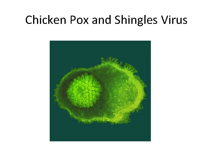 Chicken Pox and Shingles Virus 