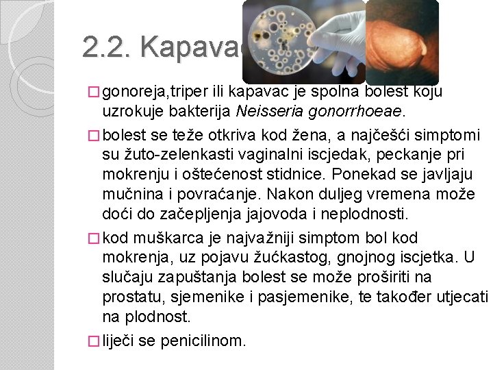 2. 2. Kapavac � gonoreja, triper ili kapavac je spolna bolest koju uzrokuje bakterija