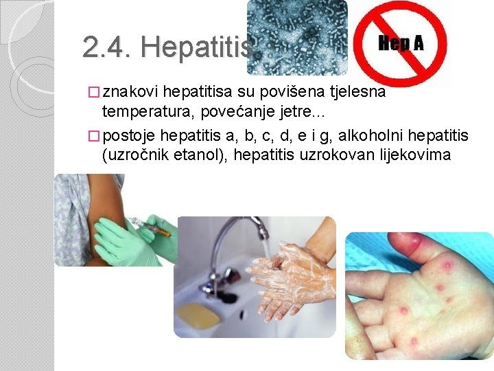 2. 4. Hepatitis � znakovi hepatitisa su povišena tjelesna temperatura, povećanje jetre. . .