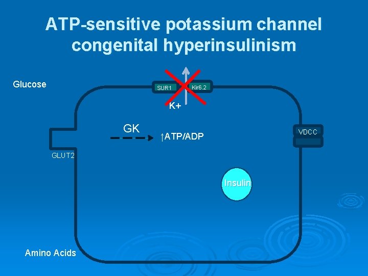 ATP-sensitive potassium channel congenital hyperinsulinism Glucose SUR 1 Kir 6. 2 K+ GK VDCC