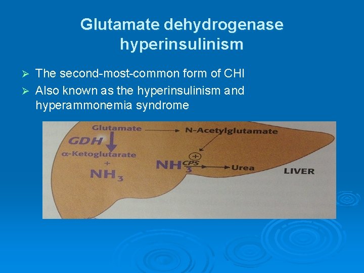 Glutamate dehydrogenase hyperinsulinism The second-most-common form of CHI Ø Also known as the hyperinsulinism