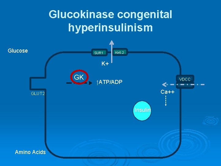 Glucokinase congenital hyperinsulinism Glucose SUR 1 Kir 6. 2 K+ GK VDCC ↑ATP/ADP Ca++