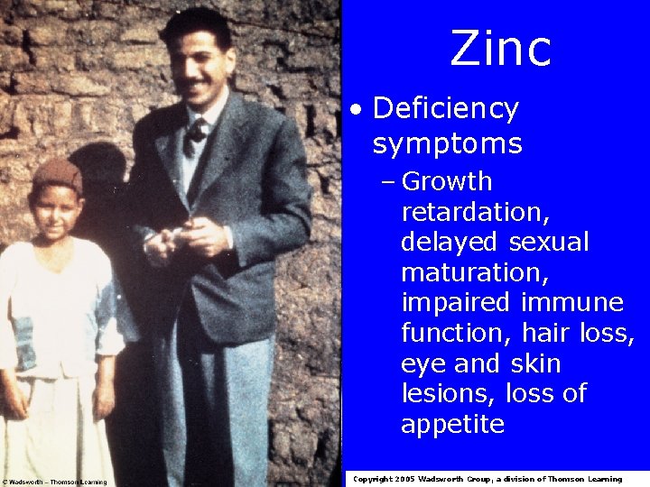 Zinc • Deficiency symptoms – Growth retardation, delayed sexual maturation, impaired immune function, hair