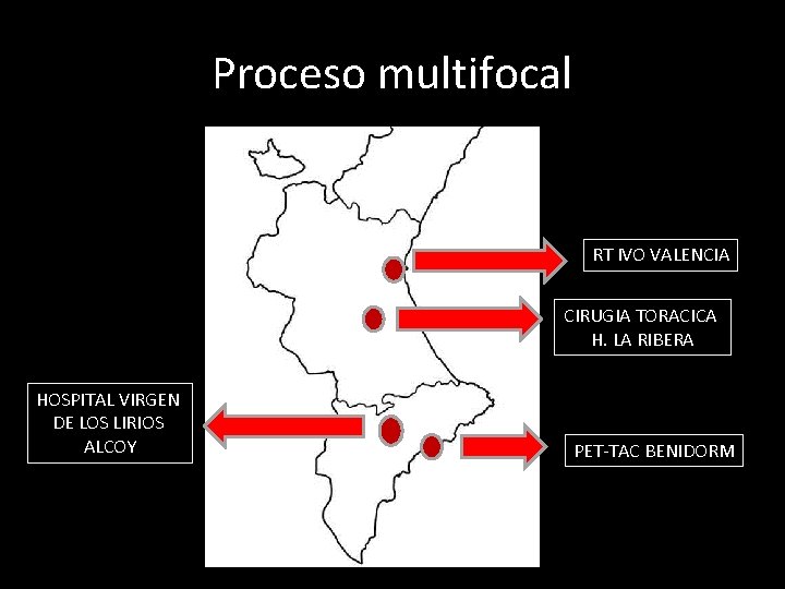 Proceso multifocal RT IVO VALENCIA CIRUGIA TORACICA H. LA RIBERA HOSPITAL VIRGEN DE LOS