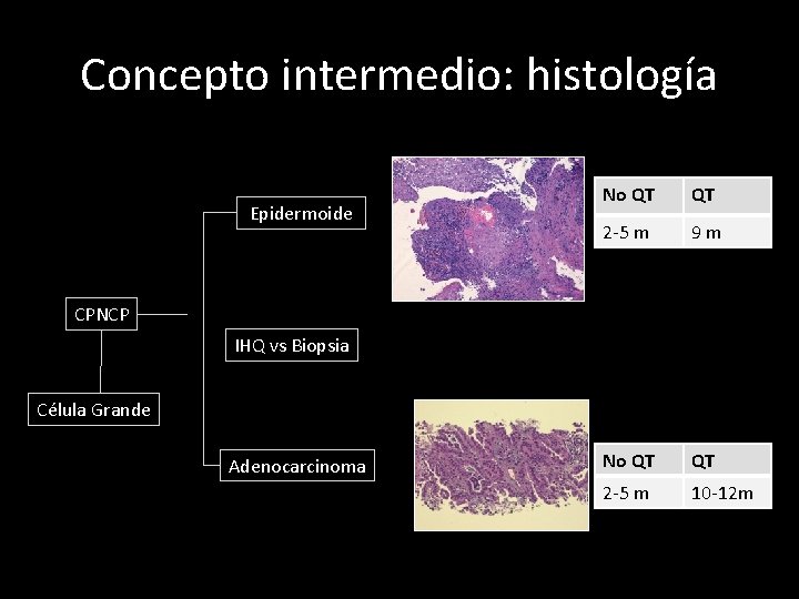 Concepto intermedio: histología Epidermoide No QT QT 2 -5 m 9 m No QT
