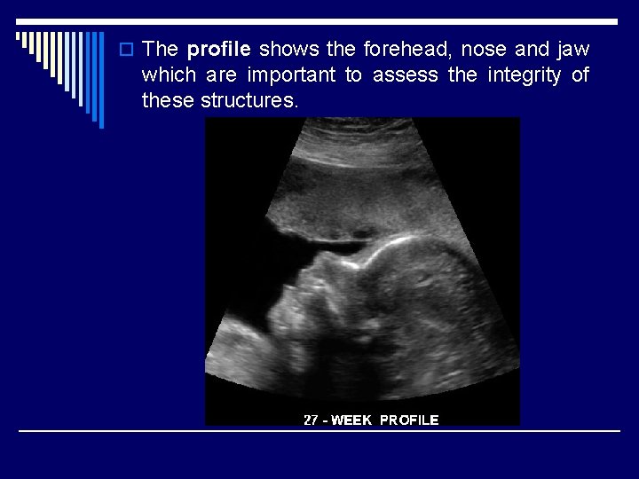 o The profile shows the forehead, nose and jaw which are important to assess