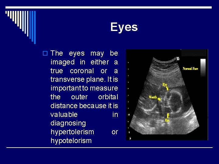 Eyes o The eyes may be imaged in either a true coronal or a