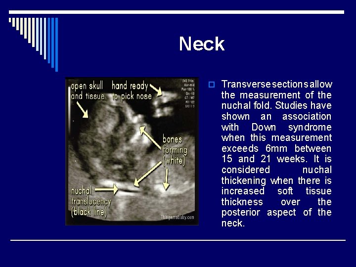 Neck o Transverse sections allow the measurement of the nuchal fold. Studies have shown