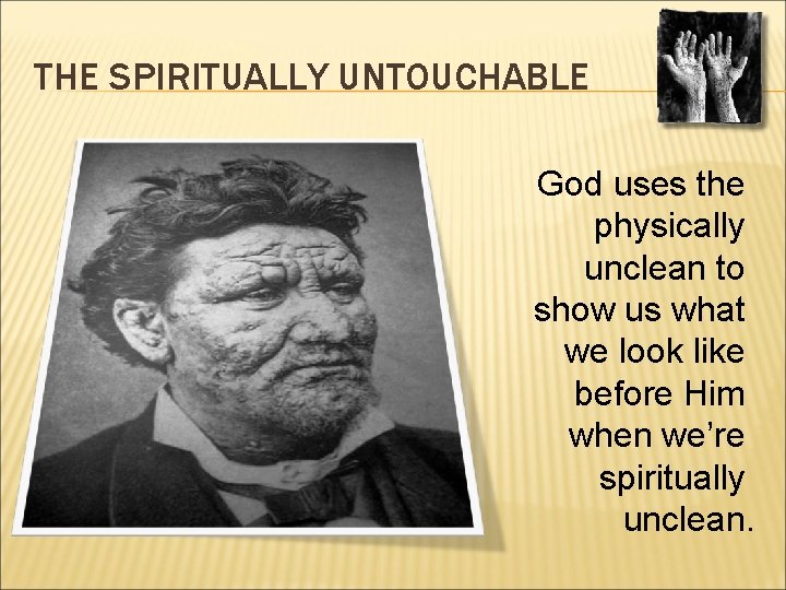 THE SPIRITUALLY UNTOUCHABLE God uses the physically unclean to show us what we look