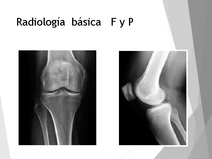 Radiología básica F y P 