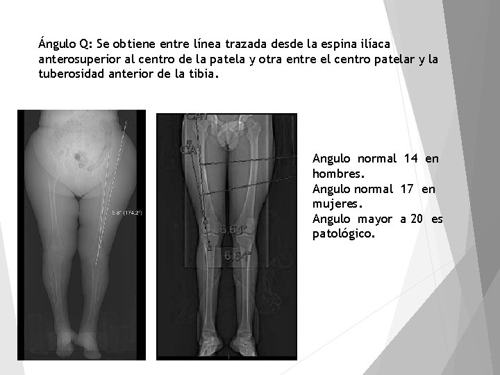 Ángulo Q: Se obtiene entre línea trazada desde la espina ilíaca anterosuperior al centro