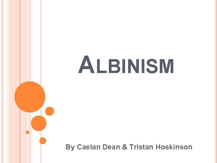ALBINISM By Caelan Dean & Tristan Hoskinson 