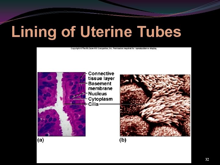 Lining of Uterine Tubes 32 