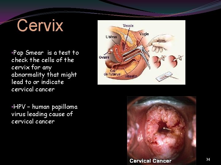 Cervix • Pap Smear is a test to check the cells of the cervix