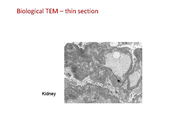 Biological TEM – thin section Kidney 