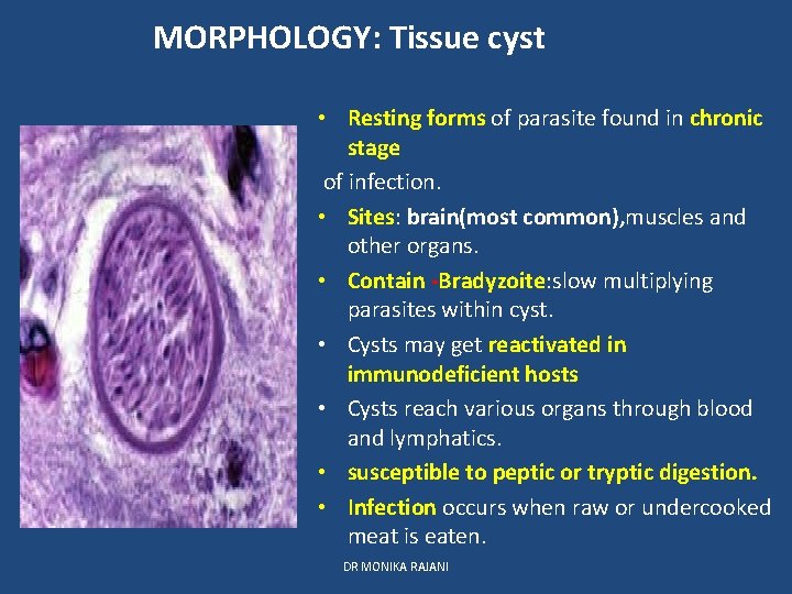 MORPHOLOGY: Tissue cyst • Resting forms of parasite found in chronic stage of infection.