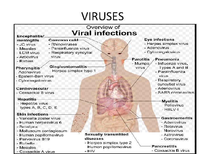 VIRUSES 