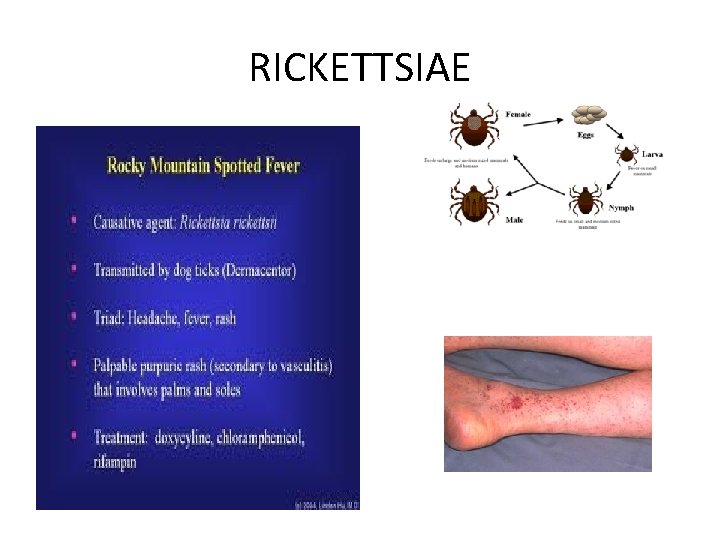 RICKETTSIAE 