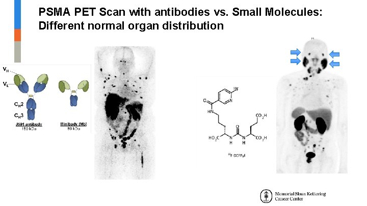 PSMA PET Scan with antibodies vs. Small Molecules: Different normal organ distribution PSMA PET Scan with antibodies vs. Small Molecules: Different normal organ distribution