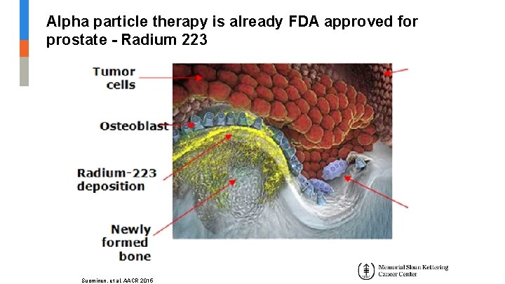 Alpha particle therapy is already FDA approved for prostate - Radium 223 Suominen, et Alpha particle therapy is already FDA approved for prostate - Radium 223 Suominen, et