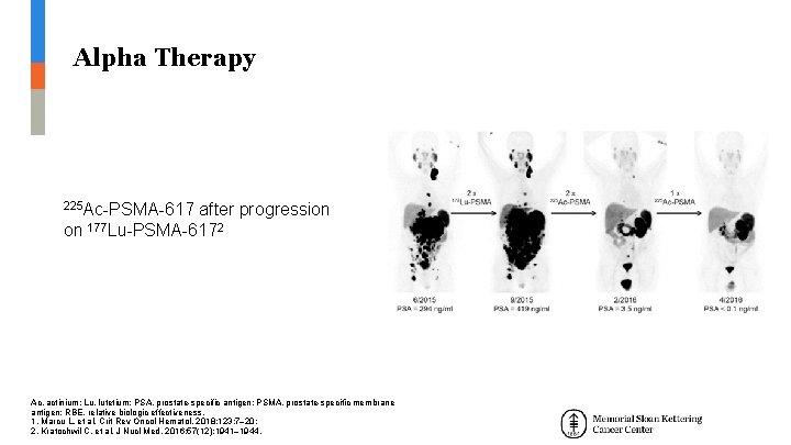 Alpha Therapy 225 Ac-PSMA-617 on after progression 177 Lu-PSMA-6172 Ac, actinium; Lu, lutetium; PSA, Alpha Therapy 225 Ac-PSMA-617 on after progression 177 Lu-PSMA-6172 Ac, actinium; Lu, lutetium; PSA,
