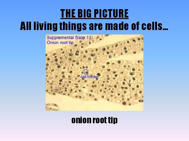 THE BIG PICTURE All living things are made of cells. . . onion root