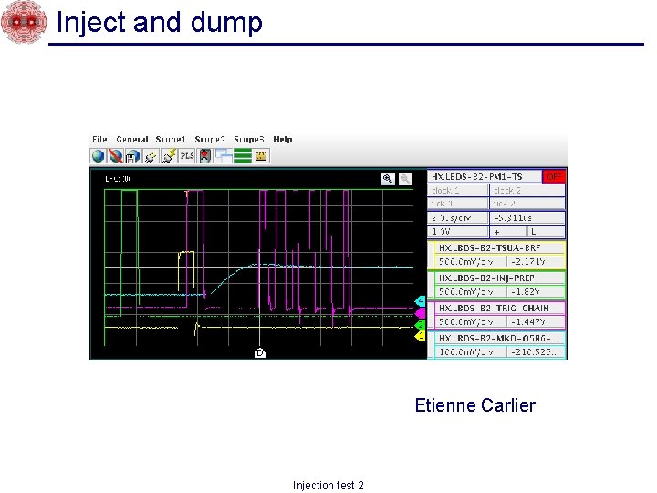 Inject and dump Etienne Carlier Injection test 2 