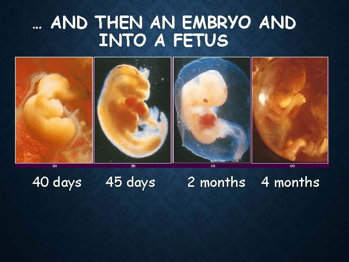… AND THEN AN EMBRYO AND INTO A FETUS 40 days 45 days 2