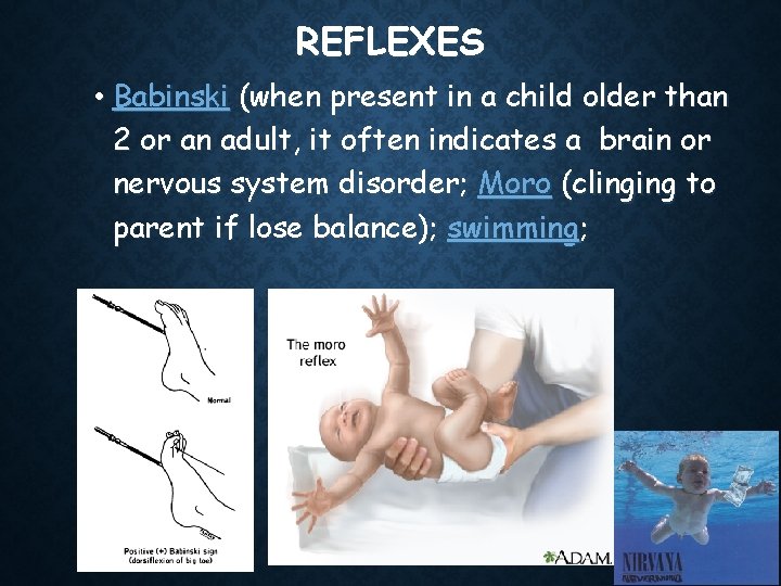 REFLEXES • Babinski (when present in a child older than 2 or an adult,